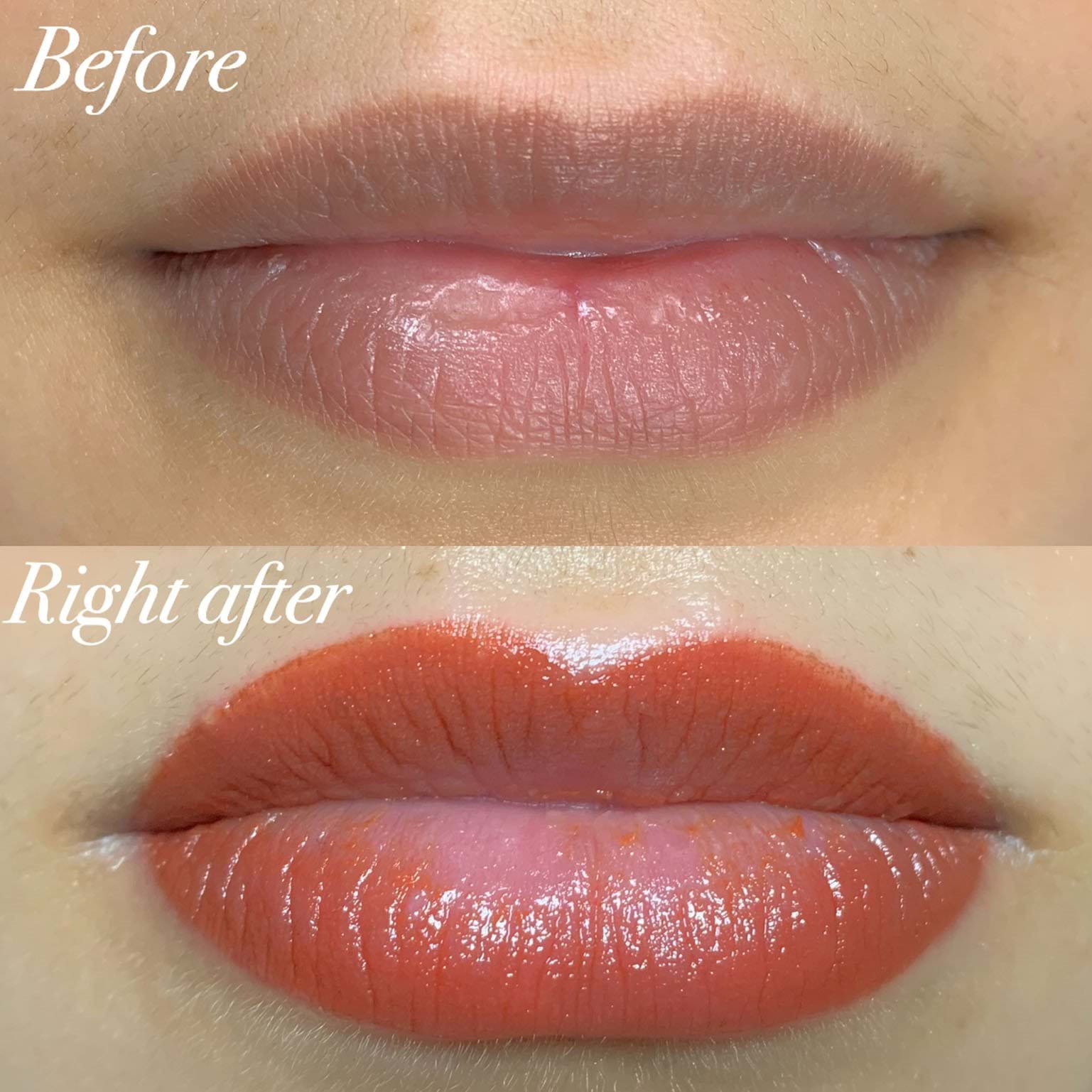Dark Lip Correction,Lip contour